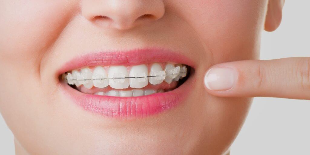 "mejores-especialistas-ortodoncia-barcelona"/