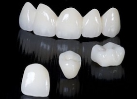 coronas-de-zirconio-en-barcelona