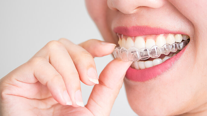 "ortodoncia-para-adultos-barcelona"/